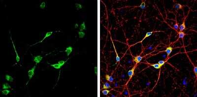 Immunocytochemistry/ Immunofluorescence: CGRP1 Antibody [NBP3-13330]