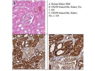 Immunohistochemistry: CH25H Antibody [NBP3-05283]