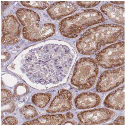 Immunohistochemistry-Paraffin: CHAC1 Antibody [NBP2-30433]