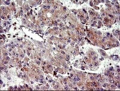 Immunohistochemistry: CHAC1 Antibody (OTI1E2) - Azide and BSA Free [NBP2-72191]