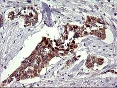 Immunohistochemistry: CHAC1 Antibody (OTI1E2) - Azide and BSA Free [NBP2-72191]