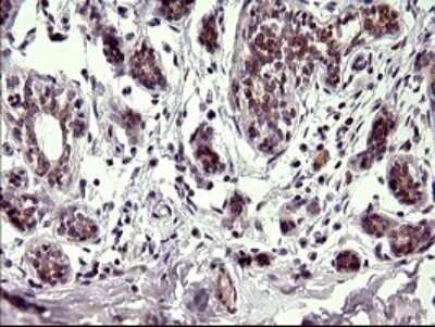 Immunohistochemistry: CHAC1 Antibody (OTI1E2) - Azide and BSA Free [NBP2-72191]