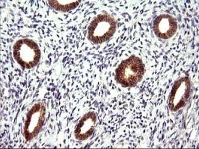 Immunohistochemistry: CHAC1 Antibody (OTI1E2) - Azide and BSA Free [NBP2-72191]