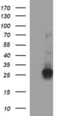 Western Blot: CHAC1 Antibody (OTI1E2)Azide and BSA Free [NBP2-72191]