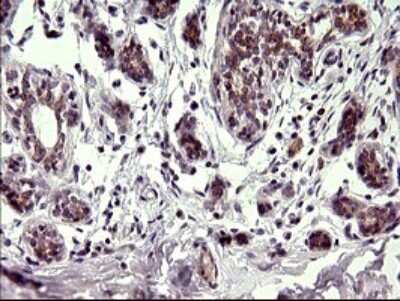 Immunohistochemistry: CHAC1 Antibody (OTI1E2) [NBP2-46273]