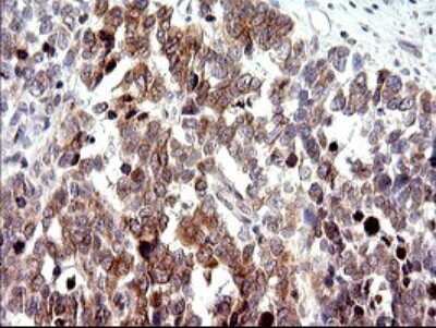 Immunohistochemistry: CHAC1 Antibody (OTI1E2) [NBP2-46273]