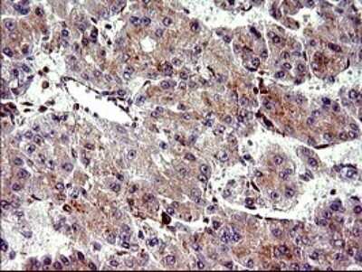 Immunohistochemistry: CHAC1 Antibody (OTI1E2) [NBP2-46273]