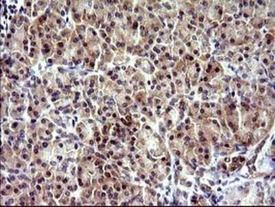 Immunohistochemistry: CHAC1 Antibody (OTI1E2) [NBP2-46273]
