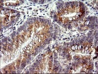 Immunohistochemistry: CHAC1 Antibody (OTI1E2) [NBP2-46273]