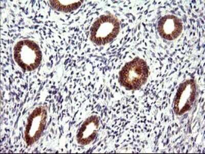 Immunohistochemistry: CHAC1 Antibody (OTI1E2) [NBP2-46273]