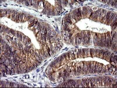 Immunohistochemistry: CHAC1 Antibody (OTI1E2) [NBP2-46273]