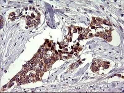 Immunohistochemistry: CHAC1 Antibody (OTI1E2) [NBP2-46273]