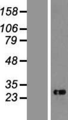 Western Blot: CHAC1 Overexpression Lysate [NBP2-06348]