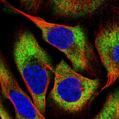 Immunocytochemistry/ Immunofluorescence: CHAC2 Antibody [NBP2-14476]