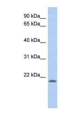 Western Blot: CHAC2 Antibody [NBP1-56821]