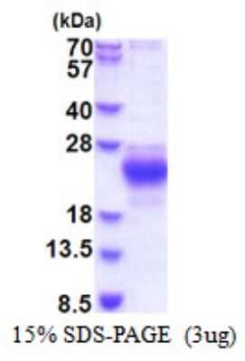 SDS-PAGE: Recombinant Human CHAC2 His Protein [NBP2-51528]