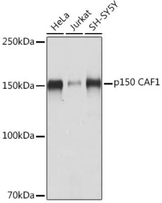 Western Blot: CHAF1A Antibody (1T1O5) [NBP3-16690]