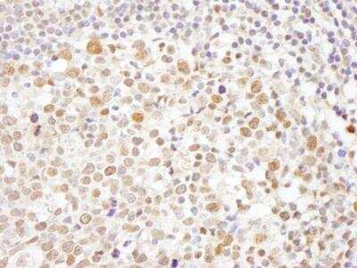Immunohistochemistry-Paraffin: CHAF1A Antibody [NB100-74608]