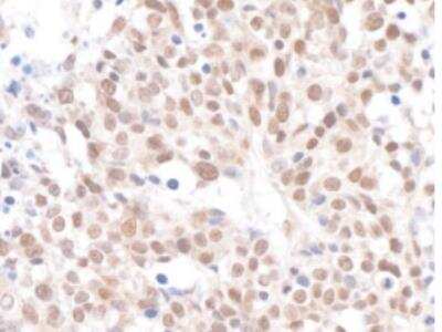 Immunohistochemistry-Paraffin: CHAF1A Antibody [NB100-74609]