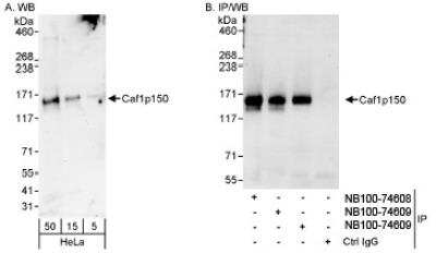 Western Blot: CHAF1A Antibody [NB100-74608]