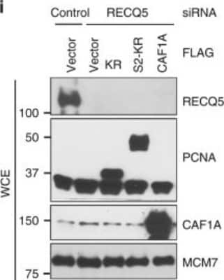 Western Blot: CHAF1A Antibody [NB100-74608]