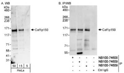 Western Blot: CHAF1A Antibody [NB100-74609]