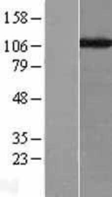 Western Blot: CHAF1A Overexpression Lysate [NBL1-09139]