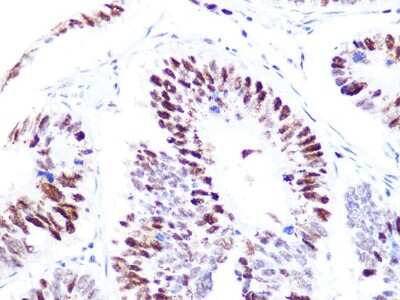 Immunohistochemistry-Paraffin: CHAF1B Antibody (7N0I2) [NBP3-16545]