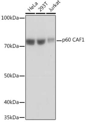 Western Blot: CHAF1B Antibody (7N0I2) [NBP3-16545]