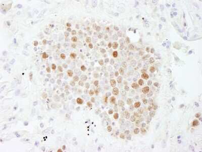 Immunohistochemistry: CHAF1B Antibody [NB100-57523]