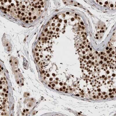 Immunohistochemistry-Paraffin: CHAF1B Antibody [NBP1-88235]