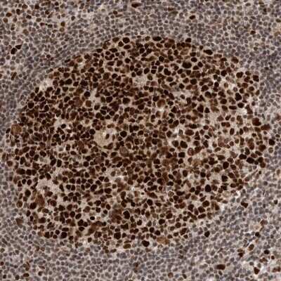 Immunohistochemistry-Paraffin: CHAF1B Antibody [NBP1-88235]