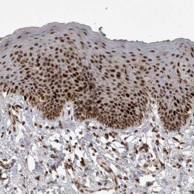 Immunohistochemistry-Paraffin: CHAF1B Antibody [NBP1-88235]