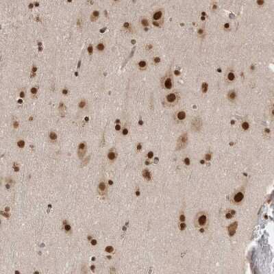 Immunohistochemistry-Paraffin: CHAF1B Antibody [NBP1-88235]