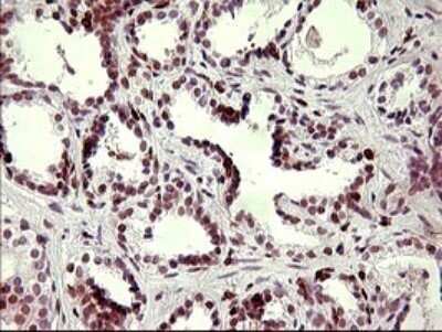 Immunohistochemistry: CHAF1B Antibody (OTI4F7) - Azide and BSA Free [NBP2-71366]