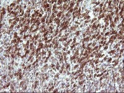 Immunohistochemistry: CHAF1B Antibody (OTI4F7) - Azide and BSA Free [NBP2-71366]