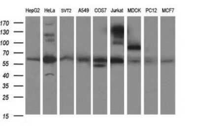 Western Blot: CHAF1B Antibody (OTI4F7)Azide and BSA Free [NBP2-71366]