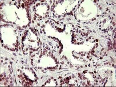 Immunohistochemistry: CHAF1B Antibody (OTI4F7) [NBP2-46274]