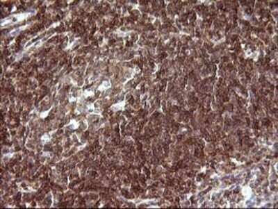Immunohistochemistry: CHAF1B Antibody (OTI4F7) [NBP2-46274]