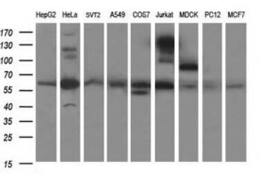 Western Blot: CHAF1B Antibody (OTI4F7) [NBP2-46274]
