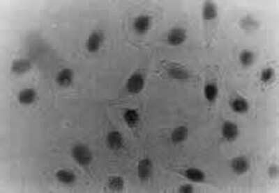 Immunocytochemistry/ Immunofluorescence: CHAF1B Antibody (SS 24 1-68) [NB500-211]