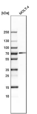 Western Blot: CHAF1B Antibody [NBP1-88235]