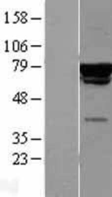 Western Blot: CHAF1B Overexpression Lysate [NBL1-09140]