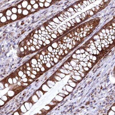 Immunohistochemistry-Paraffin: CHCHD1 Antibody [NBP1-88532]