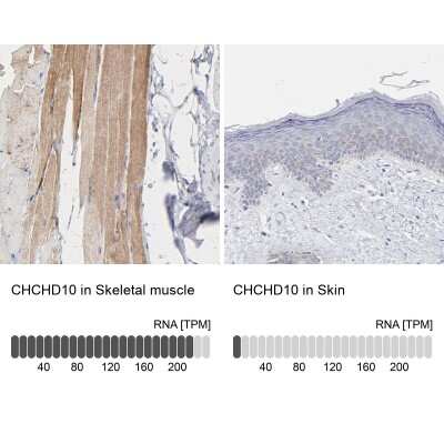 Immunohistochemistry-Paraffin: CHCHD10 Antibody [NBP1-91169]