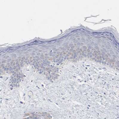 Immunohistochemistry-Paraffin: CHCHD10 Antibody [NBP1-91169]