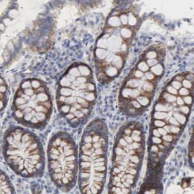 Immunohistochemistry-Paraffin: CHCHD10 Antibody [NBP1-91169]