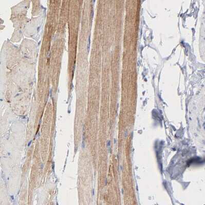 Immunohistochemistry-Paraffin: CHCHD10 Antibody [NBP1-91169]