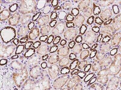 Immunohistochemistry-Paraffin: CHCHD10 Antibody [NBP3-05898]