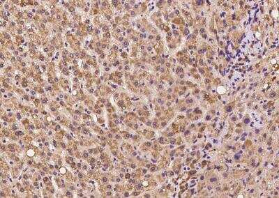 Immunohistochemistry-Paraffin: CHCHD10 Antibody [NBP3-05898]